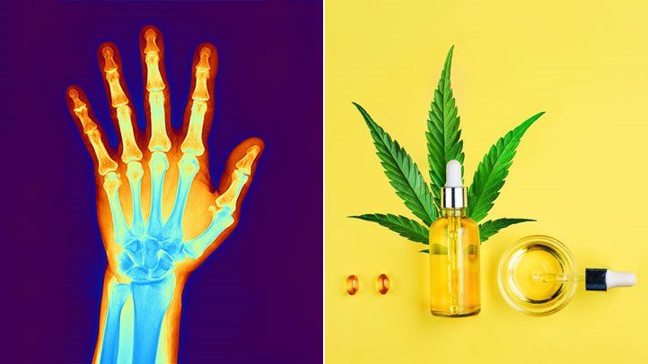 CBD and Pain Management: Harnessing the Power of Cannabidiol